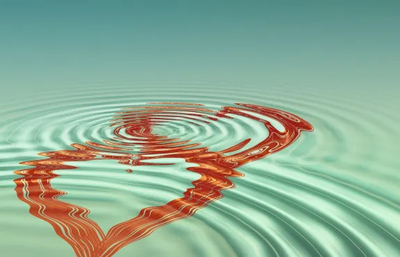 Uplayma Casino Podrška